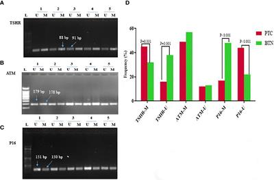 Organochlorine pesticides and epigenetic alterations in thyroid tumors